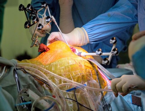 La Chirurgia Protesica Assistita dal Robot (CORA)